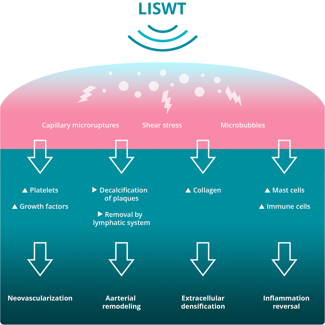 morenova features and advantages